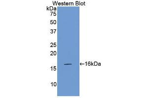 Western blot analysis of the recombinant protein. (Factor VII antibody  (AA 315-433))
