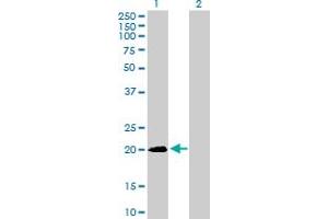 Western Blot analysis of SNX24 expression in transfected 293T cell line by SNX24 MaxPab polyclonal antibody. (SNX24 antibody  (AA 1-169))