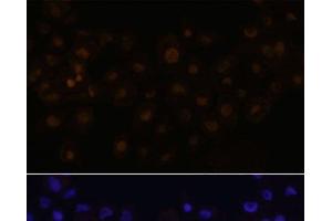 Immunofluorescence analysis of A431 cells using HEY1 Polyclonal Antibody at dilution of 1:100.