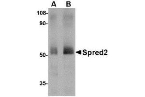 Image no. 1 for anti-Sprouty-Related, EVH1 Domain Containing 2 (SPRED2) (Internal Region) antibody (ABIN341679)