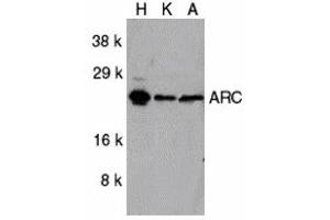 Western Blotting (WB) image for anti-ARC (C-Term) antibody (ABIN1030252) (ARC (C-Term) antibody)