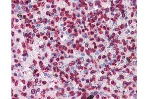Anti-HIPK1 antibody IHC of human spleen. (HIPK1 antibody  (AA 330-430))