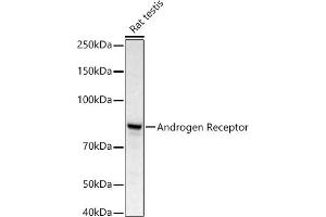 Western blot analysis of extracts of Rat testis, using Androgen Receptor antibody (ABIN3022797, ABIN3022798, ABIN3022799 and ABIN6219233) at 1:668 dilution. (Androgen Receptor antibody)