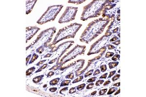 IHC analysis of AMFR using anti-AMFR antibody (ABIN4886455). (AMFR antibody  (AA 553-643))