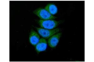 IF analysis of SBCAD/ACADSB using anti-SBCAD/ACADSB antibody (ABIN7602837). (ACADSB antibody  (C-Term))