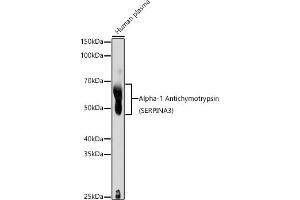 Western blot analysis of extracts of Human plasma, using Alpha-1 Antichymotrypsin (SERPIN) antibody (ABIN3016733, ABIN3016734, ABIN3016735 and ABIN6219829) at 1:1000 dilution. (SERPINA3 antibody  (AA 24-423))