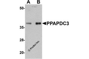 Western Blotting (WB) image for anti-Phosphatidic Acid Phosphatase Type 2 Domain Containing 3 (PPAPDC3) (Middle Region) antibody (ABIN1031044) (PPAPDC3 antibody  (Middle Region))