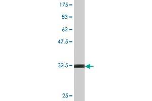 Western Blot detection against Immunogen (32. (CHFR antibody  (AA 136-194))