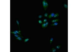 Immunofluorescent analysis of Hela cells using ABIN7159195 at dilution of 1:100 and Alexa Fluor 488-congugated AffiniPure Goat Anti-Rabbit IgG(H+L) (DMC1 antibody  (AA 5-153))