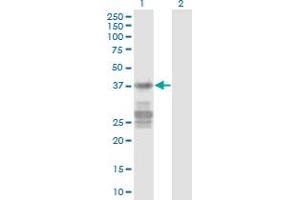 Western Blot analysis of CNN3 expression in transfected 293T cell line by CNN3 monoclonal antibody (M03), clone 2C7. (CNN3 antibody  (AA 1-329))