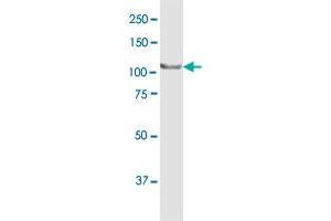 MTHFD1 MaxPab rabbit polyclonal antibody. (MTHFD1 antibody  (AA 1-935))