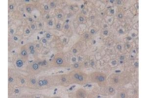 Immunohistochemistry (IHC) image for anti-Mitogen-Activated Protein Kinase Kinase 6 (MAP2K6) (AA 46-306) antibody (ABIN7443209)