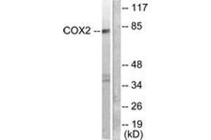 Western blot analysis of extracts from A549 cells, using Cox2 Antibody. (COX2 antibody  (AA 555-604))