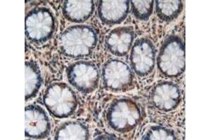 Figure. (LPCAT3 antibody  (AA 122-233))