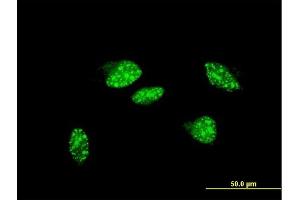Immunofluorescence of monoclonal antibody to UBR2 on HeLa cell. (UBR2 antibody  (AA 1-100))