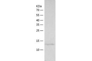 Western Blotting (WB) image for Importin 4 (IPO4) (AA 136-289) protein (His tag) (ABIN7123414) (Importin 4 Protein (IPO4) (AA 136-289) (His tag))