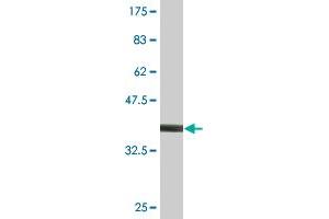 Western Blot detection against Immunogen (36. (PIK3R4 antibody  (AA 1259-1358))