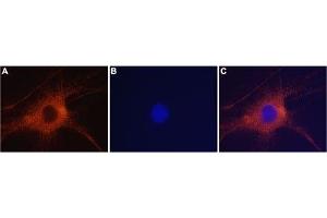 Expression of GluR6 in rat DRG neurons - Immunocytochemistry of rat dorsal root ganglion (DRG) neurons. (GRIK2 antibody  (Intracellular))