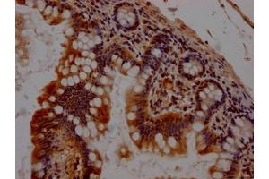 IHC image of ABIN7127424 diluted at 1:100 and staining in paraffin-embedded human small intestine tissue performed on a Leica BondTM system. (Recombinant CHEK1 antibody)