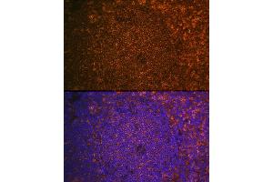 Immunofluorescence analysis of Mouse spleen using CST7 antibody (ABIN6131040, ABIN6139156, ABIN6139157 and ABIN6224188) at dilution of 1:100. (CST7 antibody  (AA 20-145))