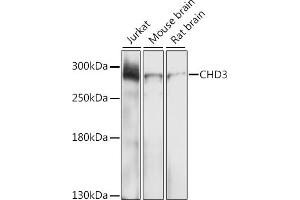Western blot analysis of extracts of various cell lines, using CHD3 antibody (ABIN6133623, ABIN6138510, ABIN6138511 and ABIN6219455) at 1:1000 dilution. (CHD3 antibody  (AA 1900-2000))
