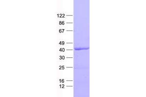 Validation with Western Blot (TARBP2 Protein (His tag))