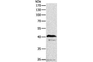 Western blot analysis of Mouse brain tissue, using ADAP1 Polyclonal Antibody at dilution of 1:500