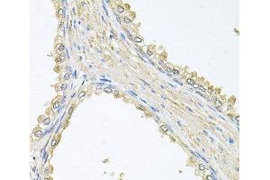 Immunohistochemistry of paraffin-embedded Human prostate using PMM2 Polyclonal Antibody at dilution of 1:100 (40x lens).