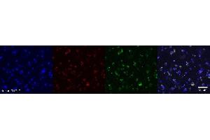 Immunohistochemistry (IHC) image for anti-Oligodendrocytic Myelin Paranodal and Inner Loop Protein (OPALIN) antibody (ABIN7456340) (OPALIN antibody)