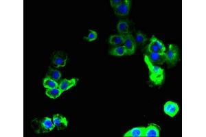 Immunofluorescent analysis of A431 cells using ABIN7166580 at dilution of 1:100 and Alexa Fluor 488-congugated AffiniPure Goat Anti-Rabbit IgG(H+L) (SLC36A2 antibody  (AA 1-58))