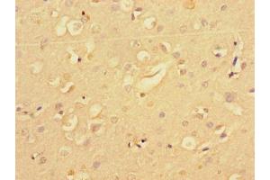 Immunohistochemistry of paraffin-embedded human brain tissue using ABIN7159413 at dilution of 1:100 (Merlin antibody  (AA 230-414))