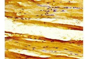 IHC image of ABIN7161089 diluted at 1:300 and staining in paraffin-embedded human skeletal muscle tissue performed on a Leica BondTM system.