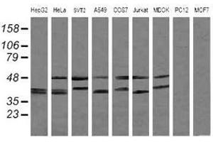 Image no. 2 for anti-Mitogen-Activated Protein Kinase Kinase 3 (MAP2K3) antibody (ABIN1499419) (MAP2K3 antibody)