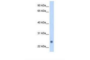 Image no. 1 for anti-Fast Skeletal Troponin I (TNNI2) (AA 51-100) antibody (ABIN321845) (TNNI2 antibody  (AA 51-100))