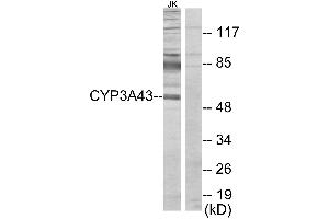 Western blot analysis of extracts from Jurkat cells, using Cytochrome P450 3A43 antibody. (CYP3A4 antibody)