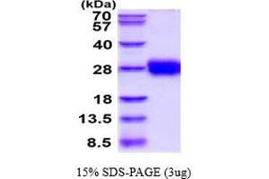 SDS-PAGE (SDS) image for Tissue Factor Pathway Inhibitor 2 (TFPI2) (AA 23-213) protein (His tag) (ABIN6387820) (TFPI2 Protein (AA 23-213) (His tag))