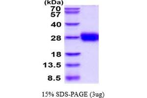 SDS-PAGE (SDS) image for Tissue Factor Pathway Inhibitor 2 (TFPI2) (AA 23-213) protein (His tag) (ABIN5777868)