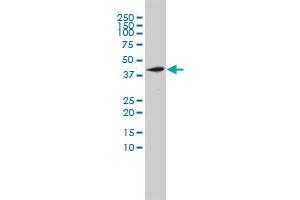 NOTCH2NL monoclonal antibody (M01), clone 2G12-2A5 Western Blot analysis of NOTCH2NL expression in HL-60 . (NOTCH2NL antibody  (AA 1-236))