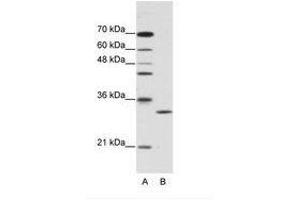 Image no. 1 for anti-Chloride Intracellular Channel 1 (CLIC1) (C-Term) antibody (ABIN202111) (CLIC1 antibody  (C-Term))