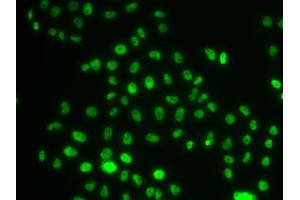 Immunofluorescence analysis of MCF-7 cells using PHIP antibody (ABIN5974339).