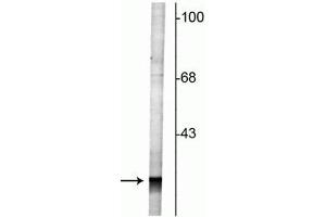Western blot of rat cortical lysate showing specific labeling of the ~27 kDa Rab3 protein. (RAB3A antibody  (N-Term))