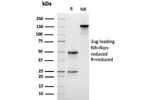 SDS-PAGE Analysis Purified Monospecific Mouse Monoclonal Antibody to LSP1 (LSP1/3042). (LSP1 antibody  (AA 174-278))