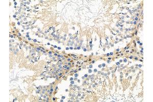 ABIN6264642 and ABIN6276374 at 1/100 staining Rat testis tissue by IHC-P.