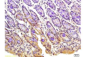 Formalin-fixed and paraffin embedded rat colon tissue labeled with Anti-Phospho-FoxO3a (Ser318/321) Polyclonal Antibody, Unconjugated (ABIN684688) at 1:200 followed by conjugation to the secondary antibody and DAB staining (FOXO3 antibody  (pSer318, pSer321))