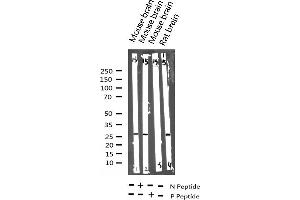 Western blot analysis of Phospho-p27 Kip1 (Thr187) expression in various lysates (CDKN1B antibody  (pThr187))