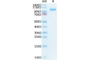 Biotinylated Human CDCP1 on Tris-Bis PAGE under reduced condition. (CDCP1 Protein (AA 30-666) (His-Avi Tag,Biotin))