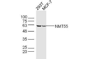 Lane 1: 293T lysates Lane 2: MCF-7 lysates probed with NMT55 Polyclonal Antibody, Unconjugated  at 1:300 dilution and 4˚C overnight incubation.