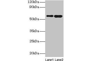 Western blot All lanes: SCP2 antibody at 2 μg/mL Lane 1: A549 whole cell lysate Lane 2: MCF-7 whole cell lysate Secondary Goat polyclonal to rabbit IgG at 1/10000 dilution Predicted band size: 59, 16, 35, 51, 7, 55, 57 kDa Observed band size: 59 kDa
