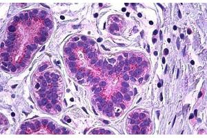 Human Breast, Epithelium: Formalin-Fixed, Paraffin-Embedded (FFPE) (VPS35 antibody  (AA 783-796))