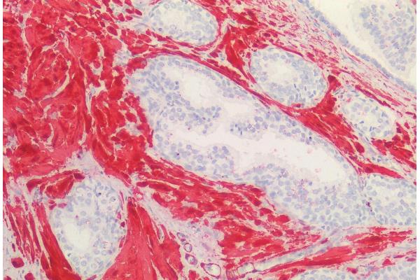 Transgelin antibody  (C-Term)
